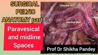 Surgical pelvic anatomy Gynecology, Paravesical spaces,space of Retzius,@saisamarthgyneclasses