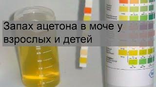 Запах ацетона в моче у взрослых и детей
