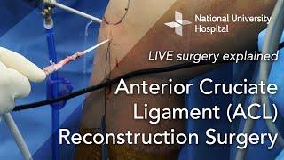 LIVE Surgery Explained: Anterior Cruciate Ligament (ACL) Reconstruction Surgery