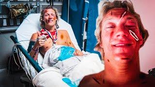 JUKKA's The WORST ACCIDENT (Dudesons)