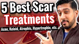 5 BEST Products for Scars | How to Get RID of Scars (All Types)