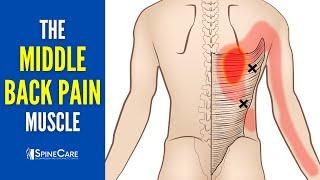 The 3 Middle Back Pain Muscles (How to Target Them for INSTANT RELIEF)