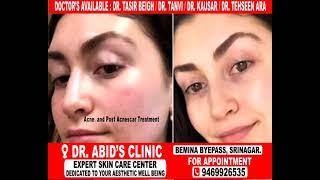 Skin treatment avaliable with the help of Laser and other modern equipments at Dr Abids clinic bemin