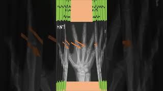 Made You Look: Rheumatology/Arthritis Picture and X-ray Quiz #1!!