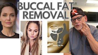 Buccal Fat Pad Removal