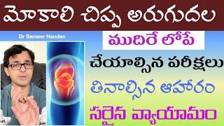మోకాలి ఆరోగ్యం మీ చేతుల్లో - Knee pain - Osteoarthritis - Complete guide - Dr Sameer Nandan