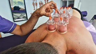 CHINESE CUPPING for BACK PAIN | How We Use Vacuum Cups at MMT