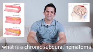 Chronic Subdural Hematoma