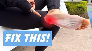 Plantar Fasciitis - Everything you Need to know!