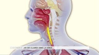 Glaires dans la gorge : comment s'en débarrasser ? - Le Magazine de la santé