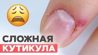 SHOCKING ripped hangnails? 5 steps for a safe manicure – BEFORE/AFTER results