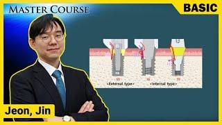 [Master Course Season2 - BASIC] Understanding Implant Abutment