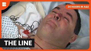 24 Hours of Life-Changing Care - 24 Hours in A&E - Medical Documentary