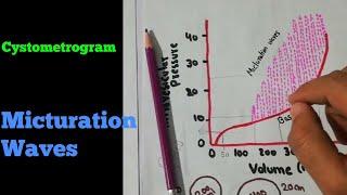 Cystometrogram | Micturition waves | Renal system 46