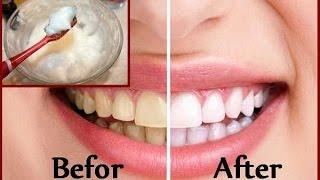 DIY Teeth Whitening at Home in 2 minutes