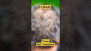 traya hair review #traya #trayahairkit