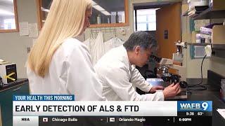 Breakthrough could provide early detection of ALS, FTD