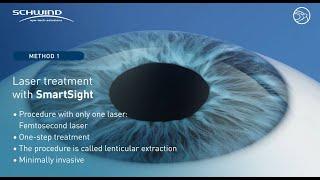 Lenticule extraction "SmartSight" with SCHWIND ATOS femtosecond laser