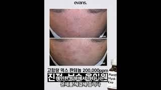 에반스 원료No. 4 판테히알엑소 #피부관리 #skincare #뷰티 #스킨케어