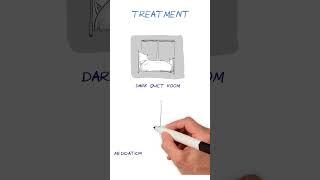 Migraines EXPLAINED #healthsketch #shorts