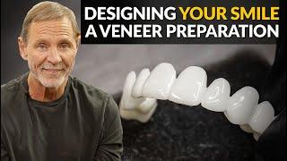 Cosmetic Dental Veneers Process - Achieving The Best Snap-On Veneer Design Possible!