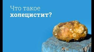 Что такое холецистит?