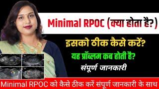 Rpoc ko kese clear kare.Rpocको कैसे ठीक करें.अल्ट्रासाउंड में Rpoc दिखाई दे रहा कैसे साफ करें.