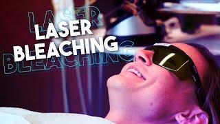 Laser Teeth Whitening at Fort Bend Dental