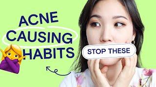 10 Acne Causing Habits | Diet, Skincare, Lifestyle | Acne School EP02 PE Class