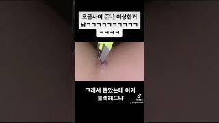 #블랙헤드 뽑기 쾌감지림