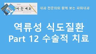 #20 위식도역류질환 Part12 수술적 치료(Nissen fundoplication)