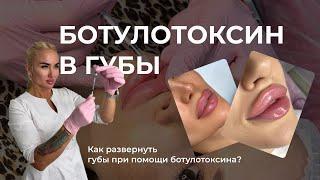 Ботулотоксин в губы | Как при помощи ботулотоксина развернуть губу? | Техника
