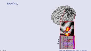 Challenges of Layer-fMRI