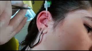 Rook Piercing   (Türkiye/Manisa Piercing)