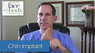 Dr. Clevens | Selecting the proper chin implant