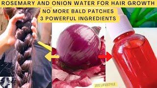 How to Make Rosemary Water | Hair Tonic for Fast Hair Growth | Onion Hair Water | Hair Fall Control