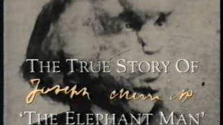 The Elephant man - QED - Documentary - The True Story Of Joseph Merrick