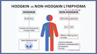 Hodgkin vs Non-Hodgkin Lymphoma Explained