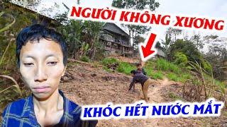 Ngu.y rồi! Em Sử tật nguyền không xương đau hoài không đỡ, bò đi từng bước ai thấy đều xót xa.