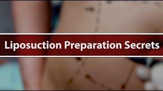 Getting Ready for Liposuction - Plastic Surgery Secrets