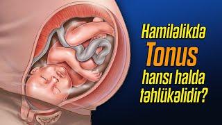 Hamiləlikdə tonus hansı halda təhlükəlidir? ( Uzman ginekoloq Aytən Nəcəfəliyeva )