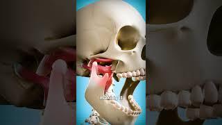 How To Fix A Dislocated Jaw 