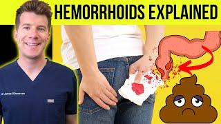 Doctor explains HEMORRHOIDS  (aka piles) | Causes, symptoms, treatment & prevention