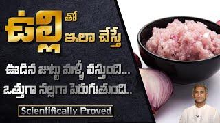 Onion for Hair Care | Home Remedy Onion for Hair Growth and Hair Fall | Dr.Manthena's Beauty tips