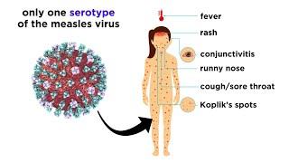Measles (Genus Morbillivirus)