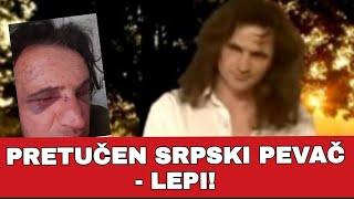 PRETUČEN SRPSKI PEVAČ - LEPI!