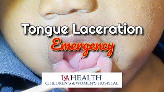 Pediatric Tongue Laceration Emergency