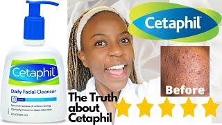 Cetaphil Skin Care Cleanser Review // Agnater