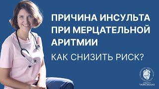 Причина инсульта при мерцательной аритмии. Как снизить риск