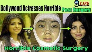 5 Bollywood Actresses Who Looks Horrible After Surgery  || Next9life